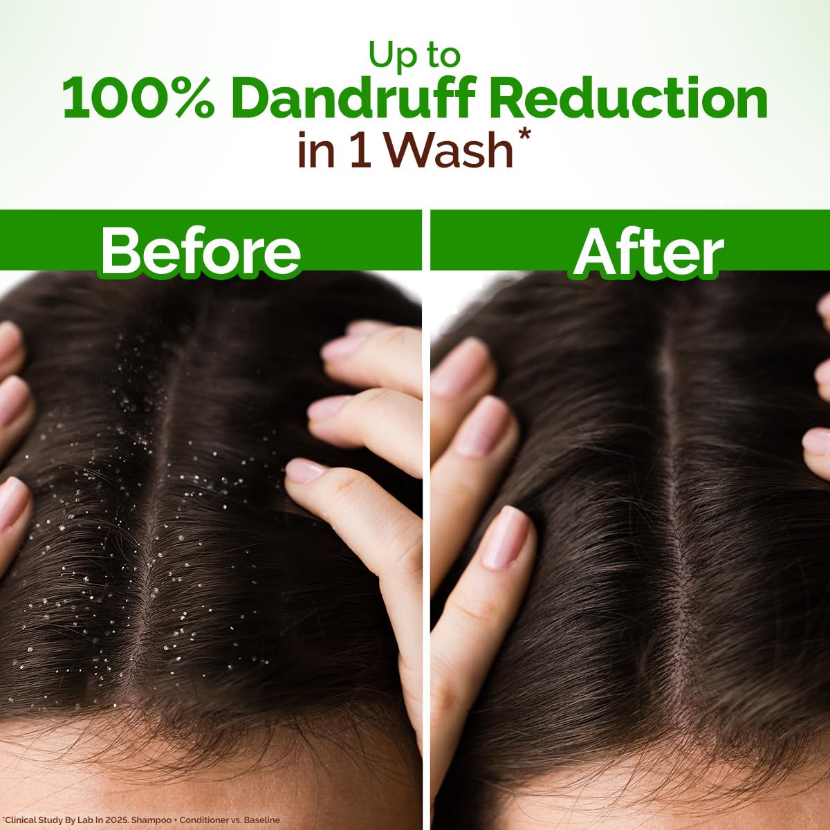 Mamaearth Lemon Anti-Dandruff Shampoo with Lemon, ZPTO, Climbazole, Aloe Vera for Itchy & Flaky Scalp | Upto 100% Dandruff Reduction & 3X Softer Hair in 1 Wash | Soothes Scalp | Reduces Frizz | 400 ml - Image 6