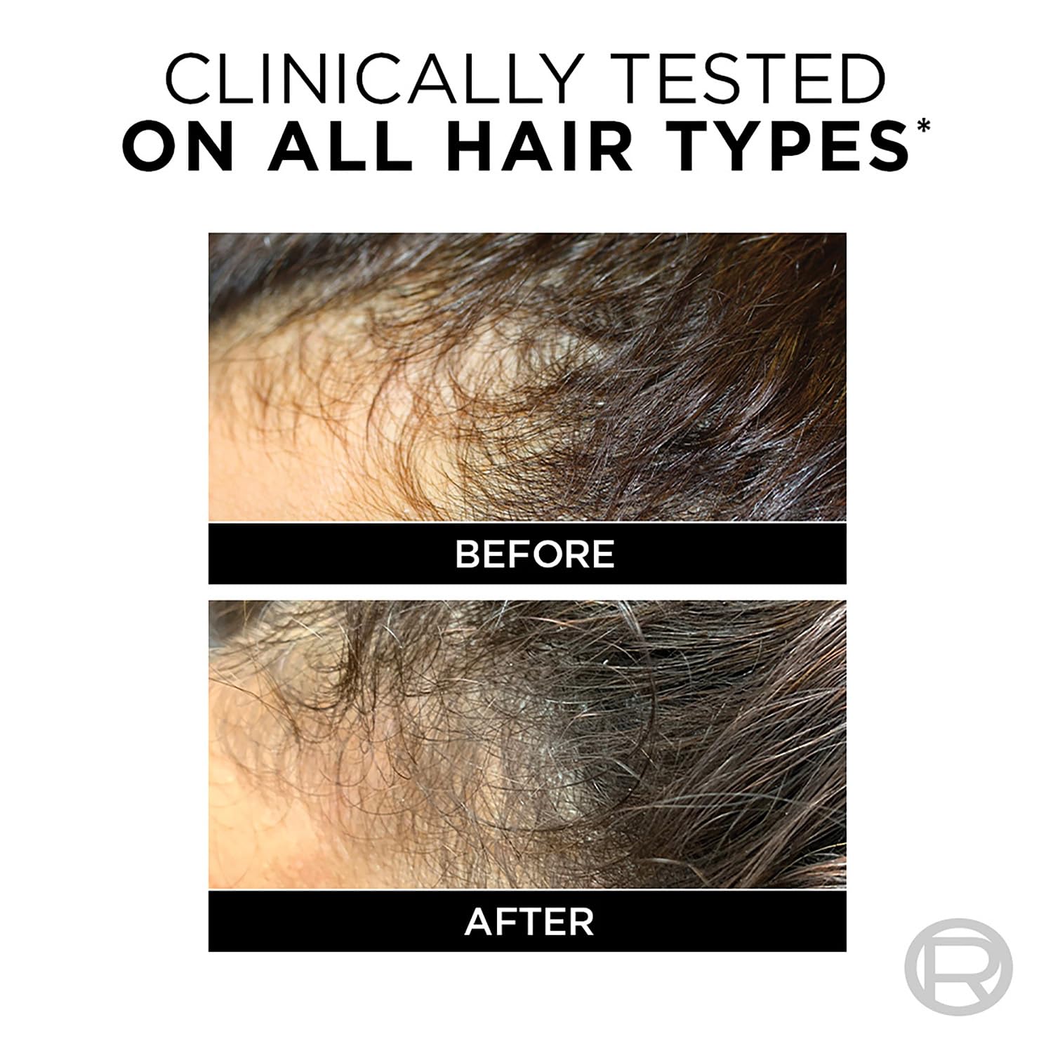 LOreal Paris Fall Resist 3X Anti-Hairfall Shampoo with Arginine Essence For Weak Hair with Tendency to Fall and Hair Thinning, Reduces Hair Breakage and Nourishes Roots- 650ml - Image 6